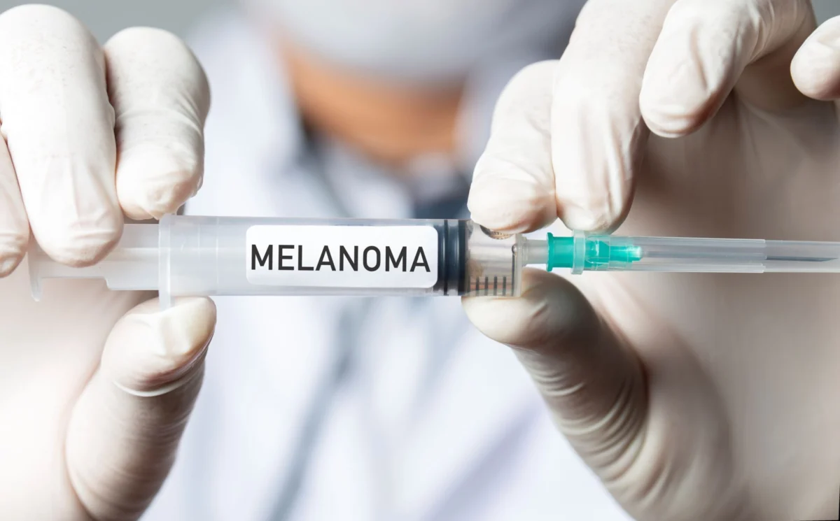 A Paradigm Shift in Oncology: Phase 3 Trial Reveals Personalized mRNA Vaccine Cuts Melanoma Recurrence and Death Risk by 42 Percent